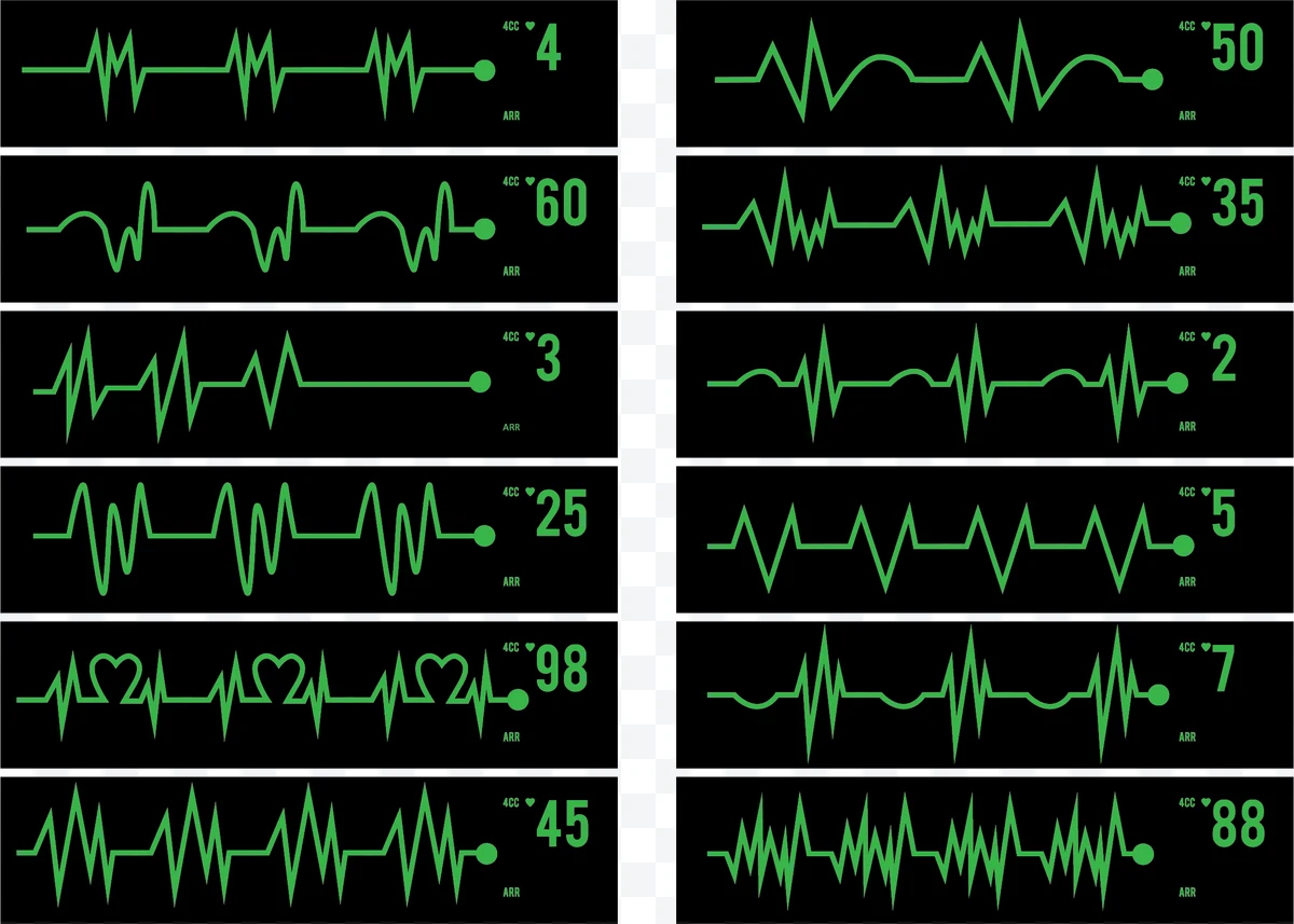 Electrocardiogram