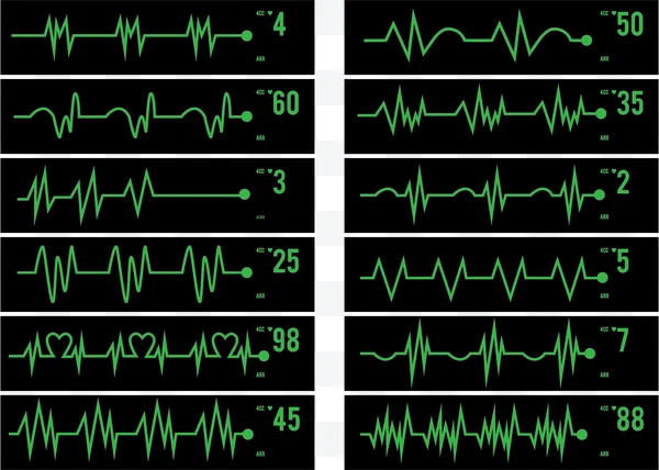 Electrocardiograma